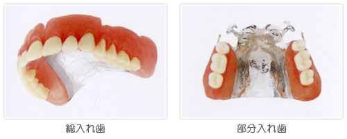 チタン床Photo